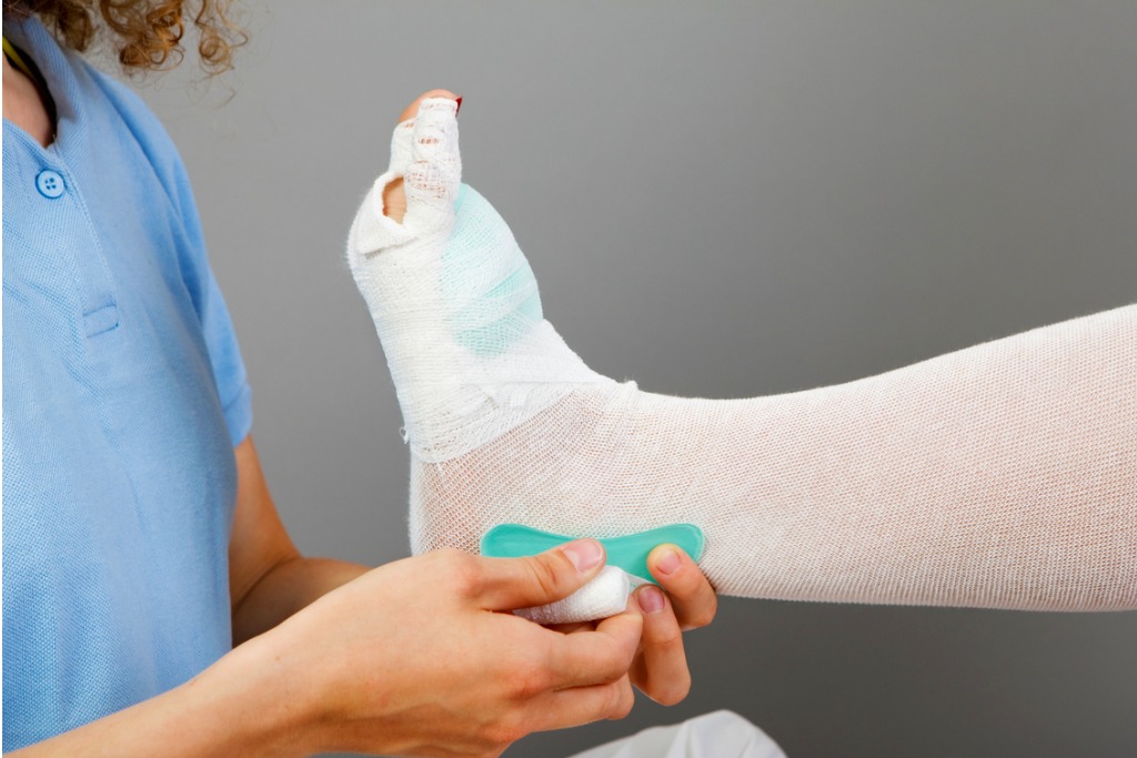 guide to lymphoedema