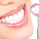 teeth whitening fitzroy north