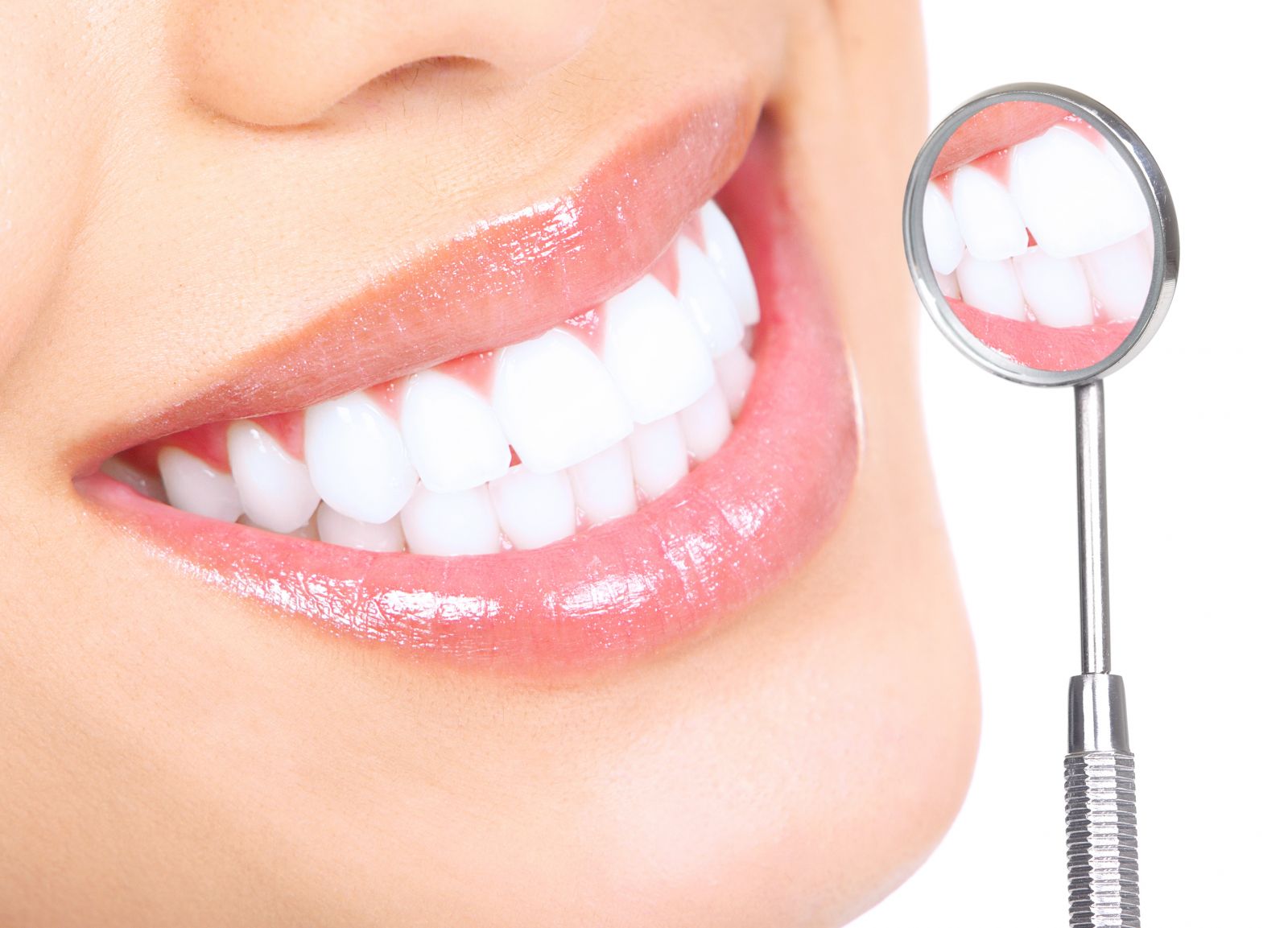 teeth whitening fitzroy north