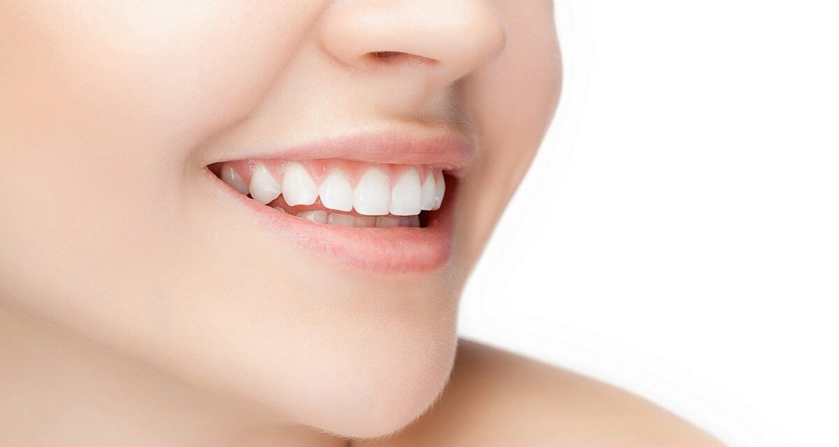 smile makeover epping
