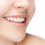 smile makeover epping