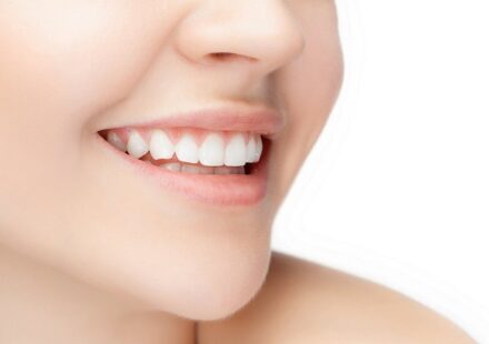 smile makeover epping